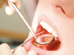 ラバーダム防湿